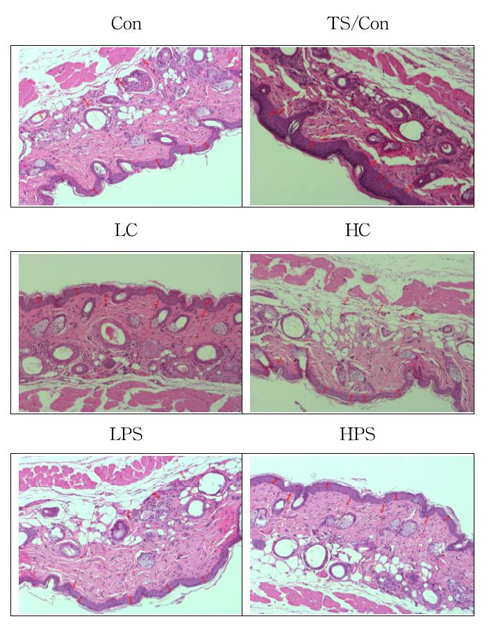 Histological section of hairless mouse dorsal skin exposed to chronic UV irradiation.