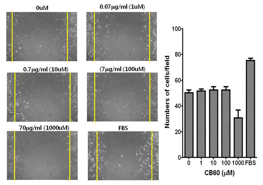 Effect of glucosylceramide on cell migration in BAEC cells