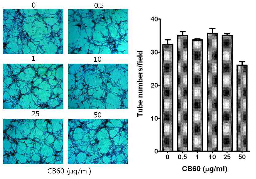 Effect of glucosylceramide on tube formation in BAEC cells