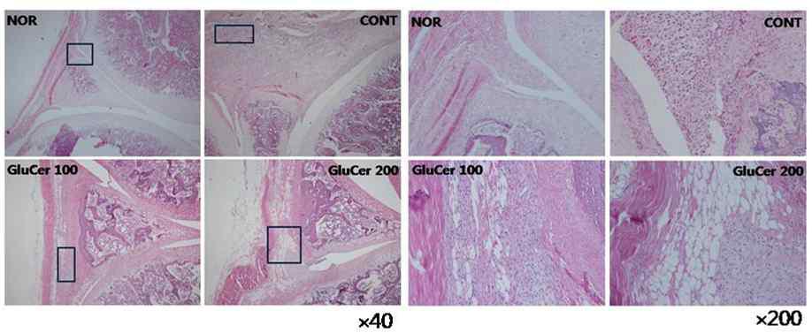 Effects of GluCer on histological features of knee joint in carrageenan- induced arthritis rats using Hematoxylin and eosin stain.