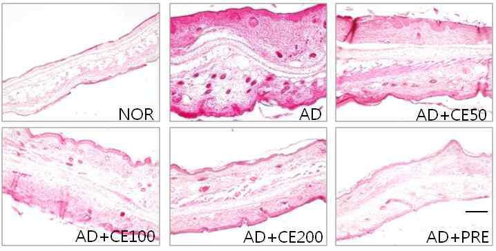 Effects of glucosylceramide on histological features of ear skin lesions in TMA-induced atopic mice