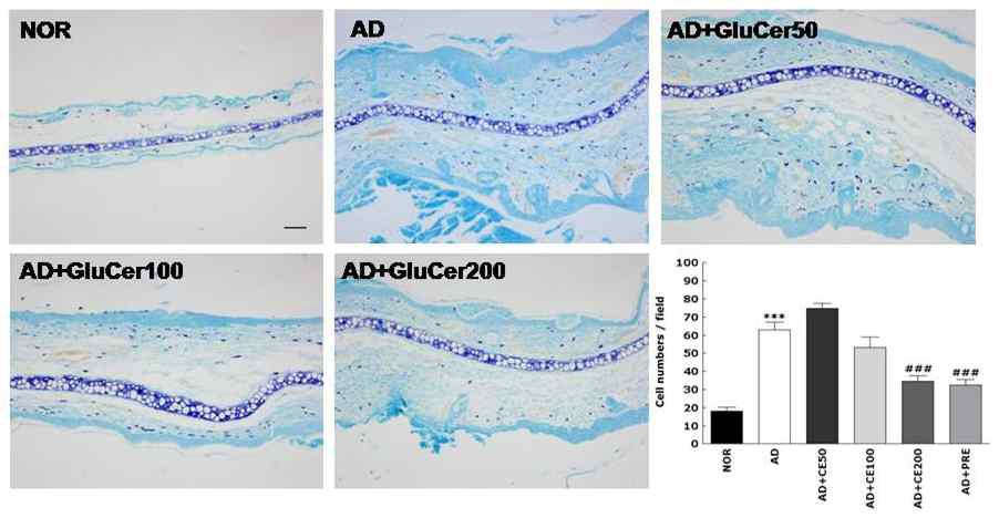 Effects of GluCer on mast cell infiltration into ear skin lesions in TMA-induced atopic mice