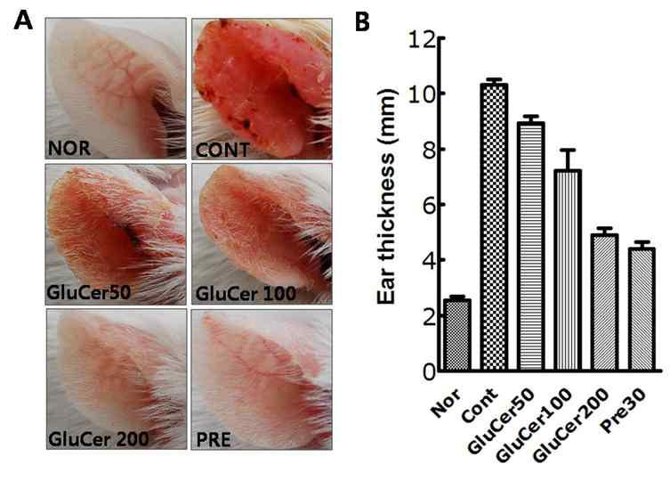 Effects of GluCer on clinical observation of ear skin (A) and ear thickness (B) in oxazolone-induced ear eczma in mice