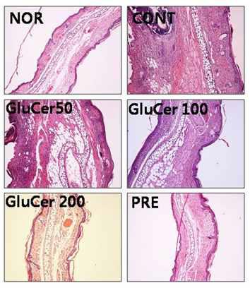 Effects of GluCer on histological features of ear skin lesions in oxazolone -induced ear eczma mice.