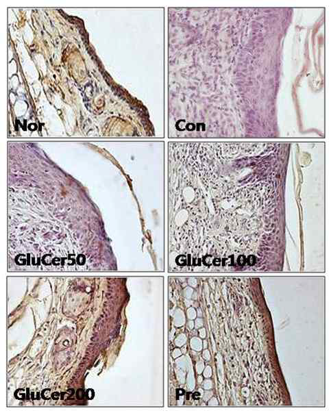 Effects of GluCer on water contents of the ear skin lesions (A) and the expression of AQP-3 (B) in oxazolone-induced ear eczma in mice