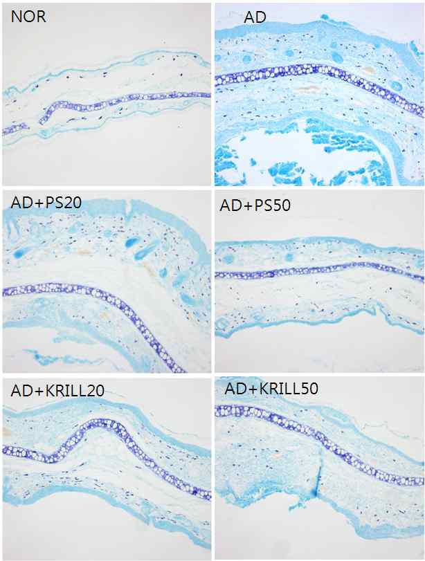 Effects of GluCer on mast cell infiltration into ear skin lesions in TMA-induced atopic mice