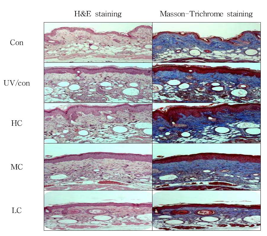 Histological section of dorsal skin of hairless mice exposed to the chronic UV irradiation.