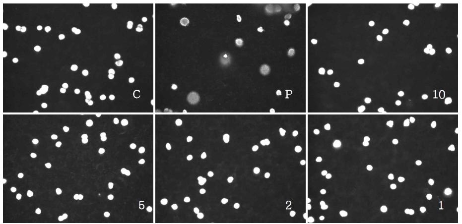 발효진피의 HT-29에 대한 COMET assay 결과