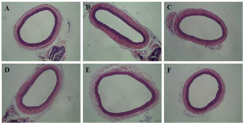 Representataive histological photographs of OVX SD rat carotid artery