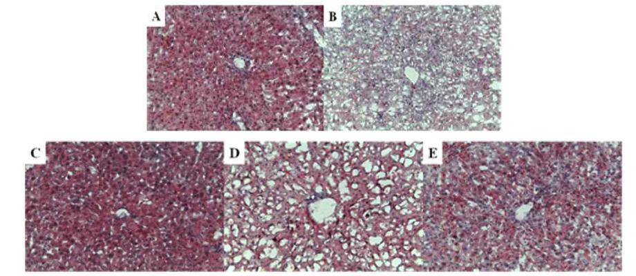 Degree of hepatic steatosis in the mice fed high cholesterol diet containing different oils for 10 weeks.