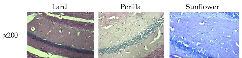 Histological analysis of the brain in apoE ko mice.