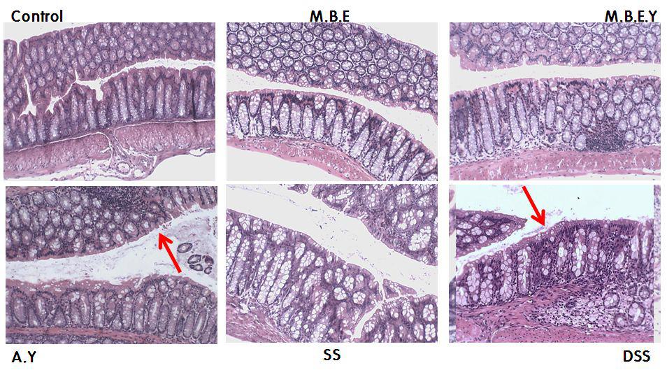 장염증 모델 실험 후 H&E염색에 의한 각 실험군의 조직학적 검사