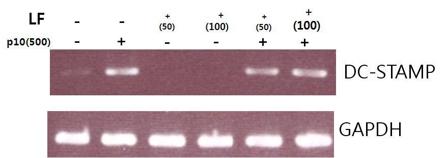 U937세포에서 DCmarker관련 유전자들의 발현