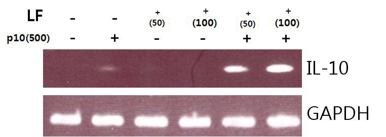 U937세포에서 IL-10유전자의 발현