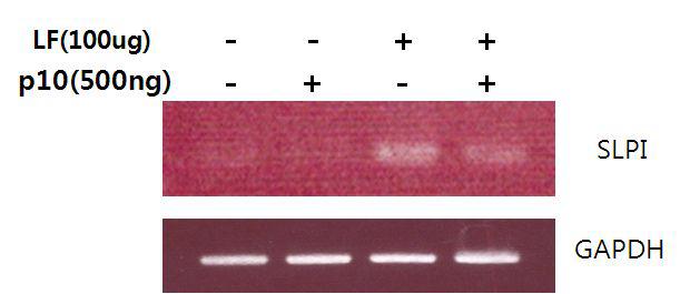 U937세포에서 SLPI유전자의 발현