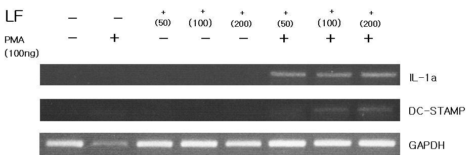 NK92세포에서 IL-1α와 Dc-stamp유전자의 발현