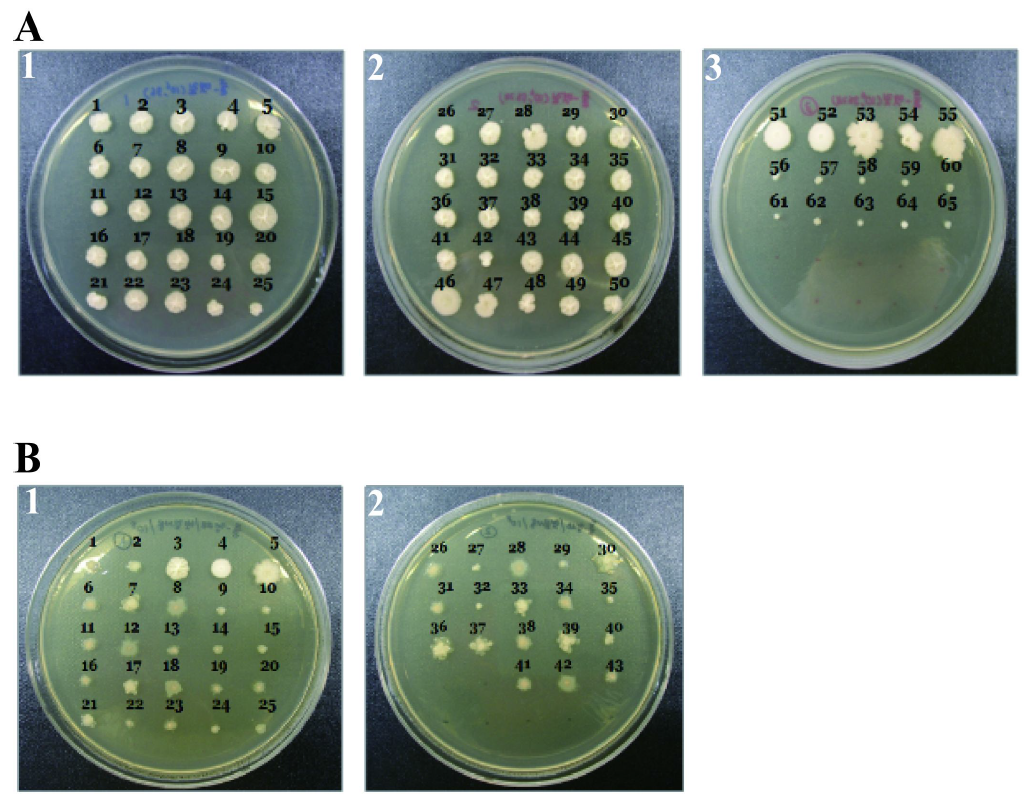 Isolated microorganisms from rice-straw (A) and Chungkookjang (B) in Pulmoksan farm (Gyeonggi area)on the tryptic soy agar.