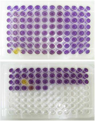 Color reaction of selected strains in decarboxylase medium.