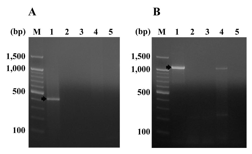 PCR products of decarboxylase genes amplified with specific primers from selected microorganisms.