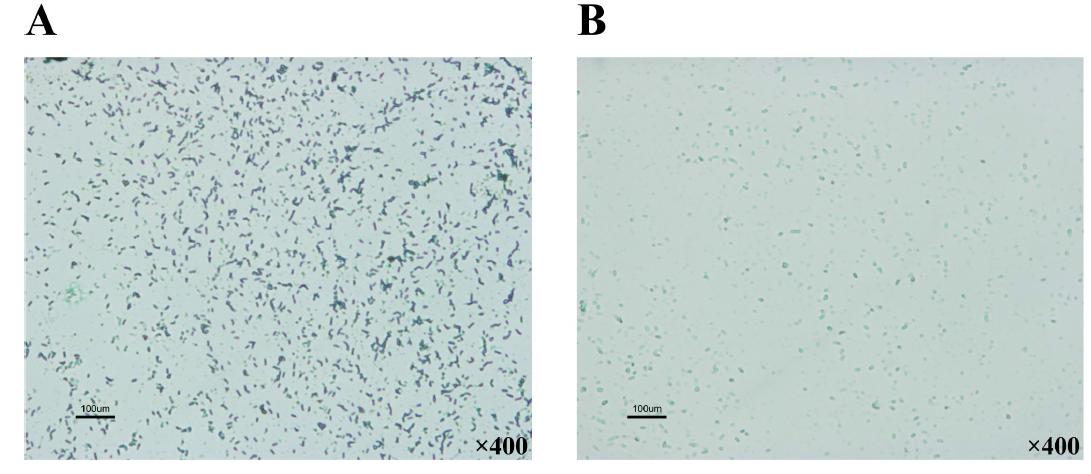 Malachite green staining of spores produced from B.amyloliquefaciens KC41 on microscopy