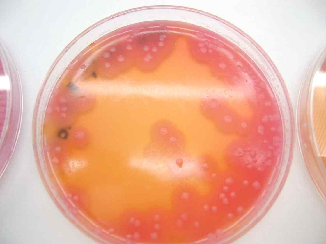 Bacillus cereus on MYP agar plate.