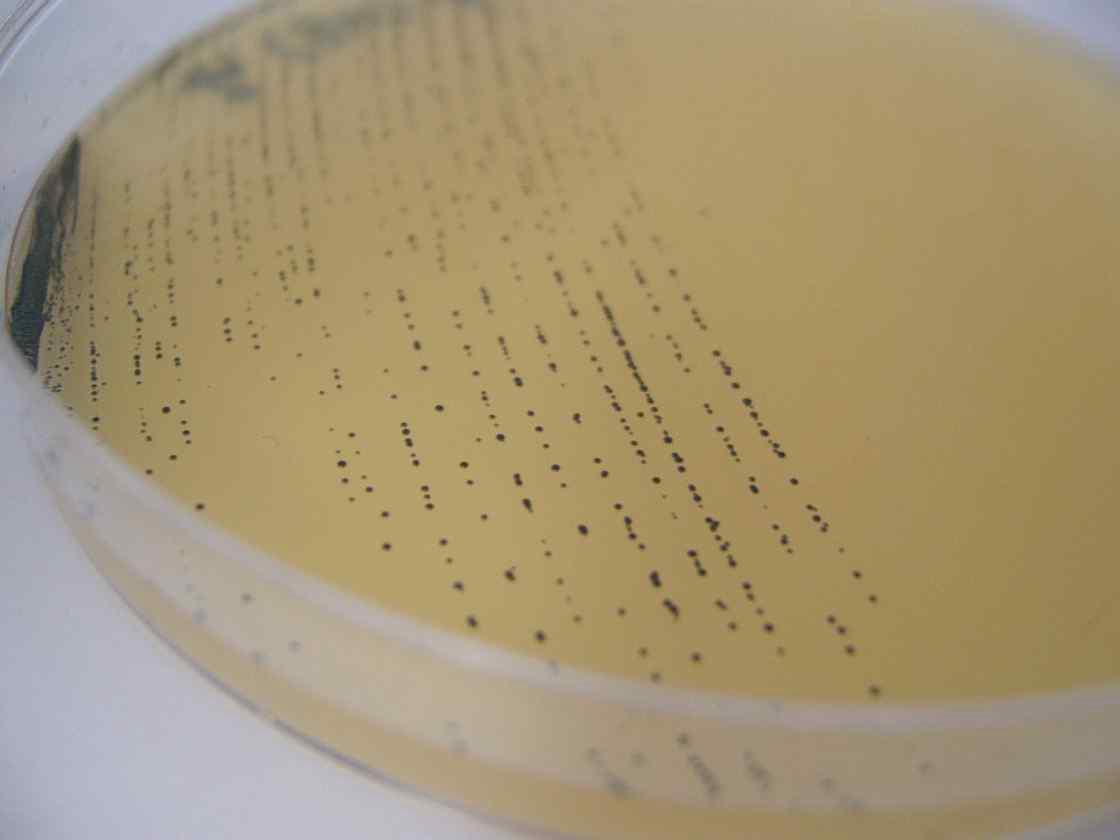 Staphylococcus aureus on Baird-Parker agar plate.