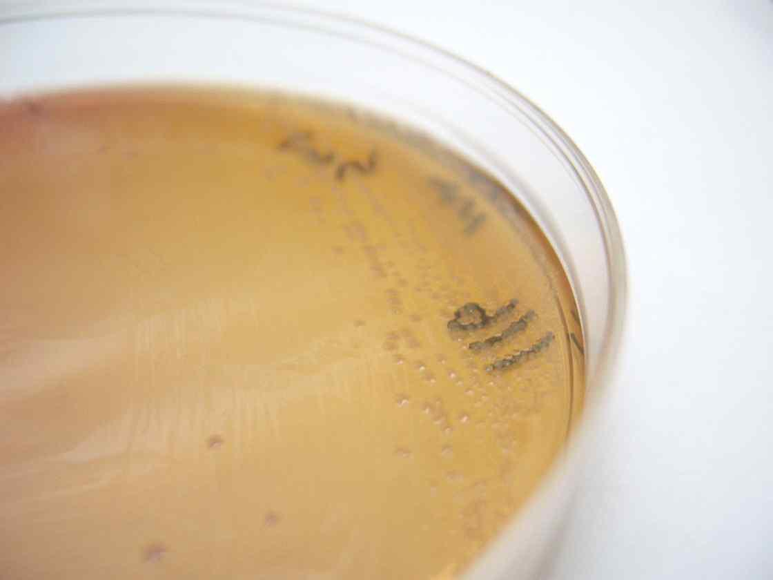 Salmonella spp. on MacConkey agar plate.