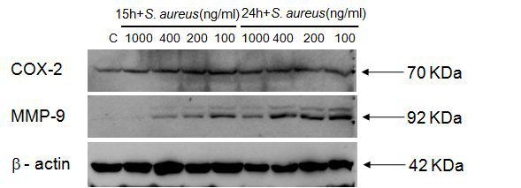 Protein expression of COX-2 and MMP-9 induced by S. aureuss extracts in HEKs.
