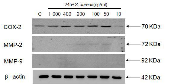 Protein expression of COX-2, MMP-2 and MMP-9 induced by S. aureus extracts in HMC-1.