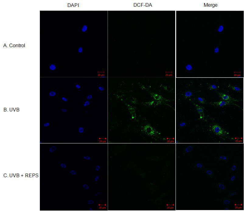 REPS inhibits ROS production from UVB-irradiated HDFs.