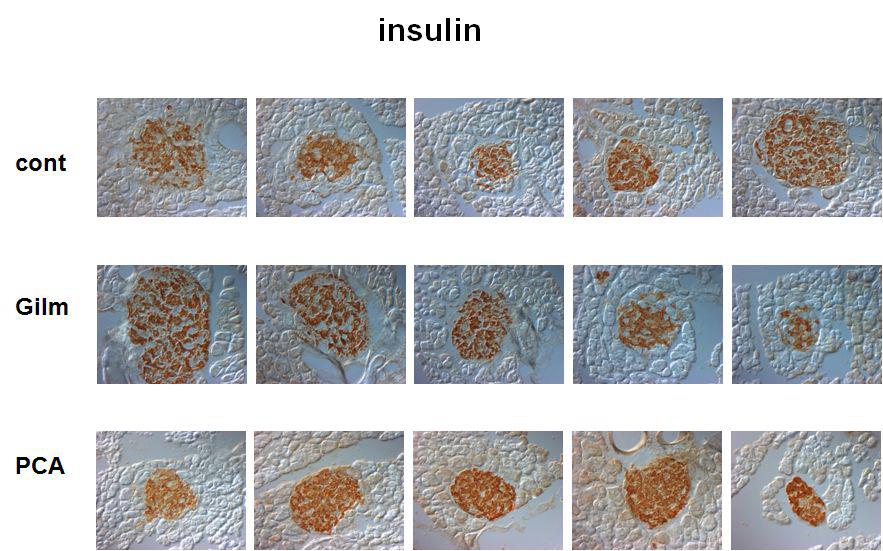 췌장 islet을 anti-insulinantibody로 면역염색화학적 분석 결과