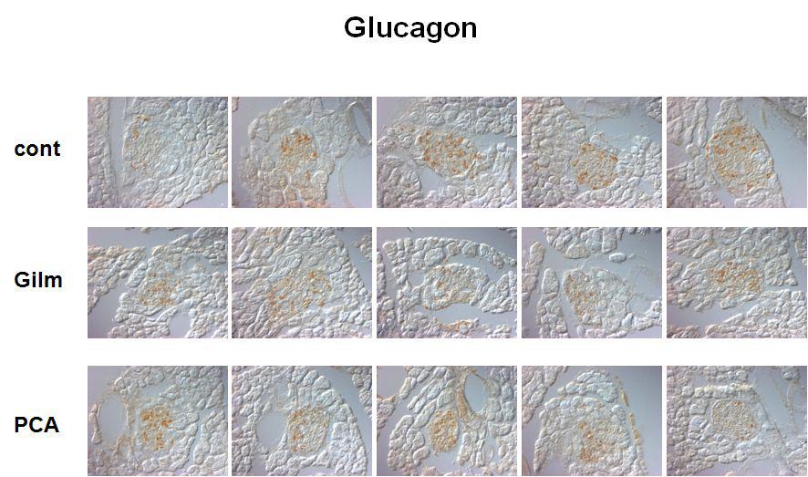 췌장 islet을 anti-glucagonantibody로 면역염색화학적 분석 결과