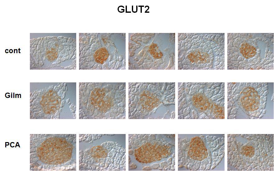 췌장 islet을 anti-glut2antibody로 면역염색화학적 분석 결과