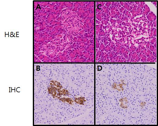 Immunohistochemistry (IHC) of pancreas using insulin antibody.