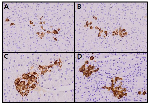 Immunohistochemistry (IHC) of pancreas using insulin antibody.