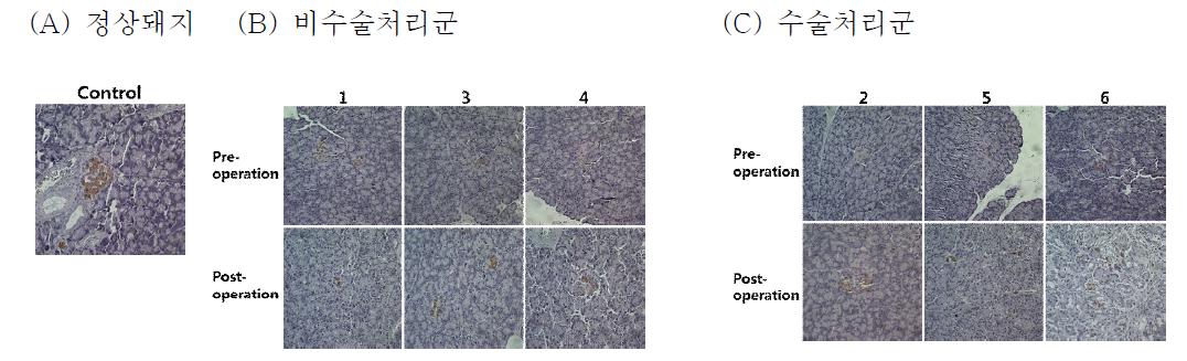 Immunohistochemistry (IHC) of pancreas using insulin antibody.