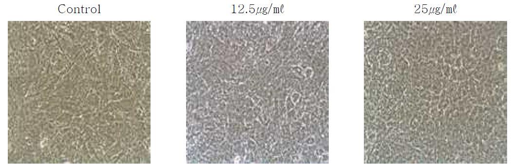 Primary cell after differentiation with or without different concentration of Zn-Vit C