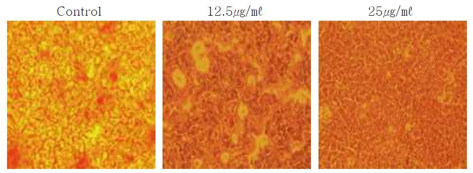 Primary cell after differentiation with or without different concentration of Zn-Vit C analyzed by Oil-red-O