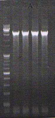 PCR product of RSTB1
