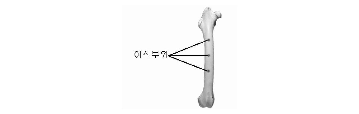 그림 7. 이식 부위의 위치