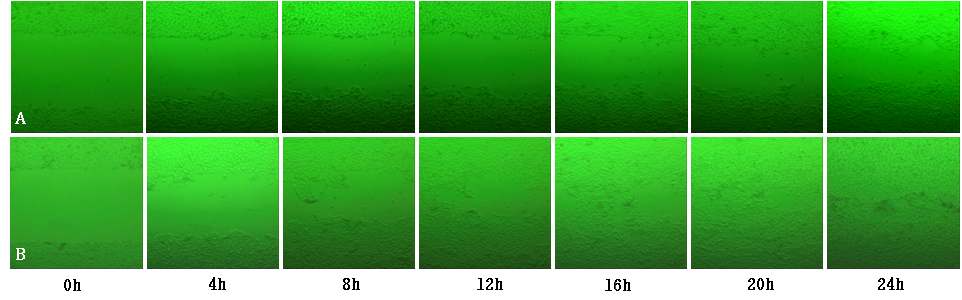그림 10. 난각막 가수분해물이 창상 처리된 HaCaT 세포의 회복에 미치는 효과