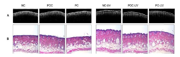 Two-dimensional PS-OCT images (A) and H&E staining (B) of mice treated by oral administration of propolis extract.