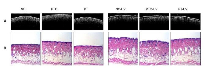 Two-dimensional PS-OCT images (A) and H&E staining (B) of mice treated by topical application of propolis extract.