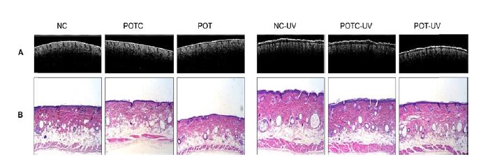 Two-dimensional PS-OCT images (A) and H&E staining (B) of mice treated by oral /topical administration of propolis extract.