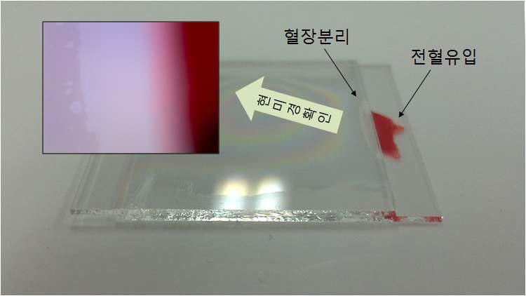 공간갭 필터를 이용한 혈액/혈장 분리