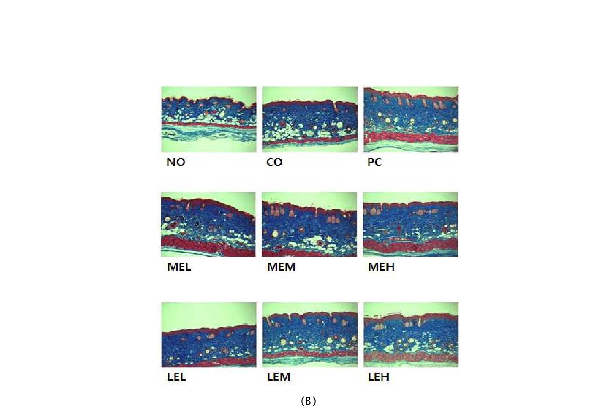 Histologic change of SKH-1 harilees mice skin after 7-weeks experiment (×100).