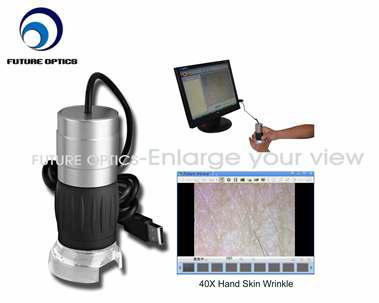 USB handheld skin analyzer-Future Optics(중국)