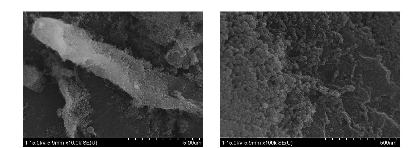 4회의 재사용 실험 후의 NP로 코팅된 C. glutamicum의 FE-SEM 사진