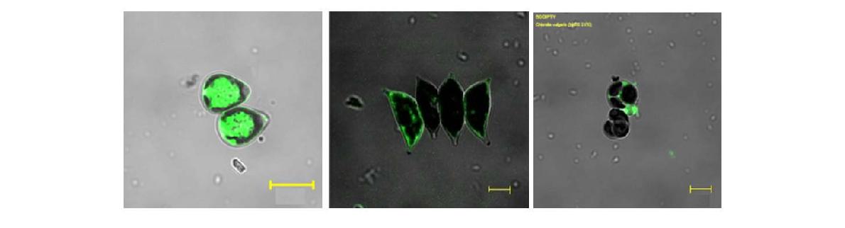 BODIPY에 염색된 미세조류의 현미경 사진
