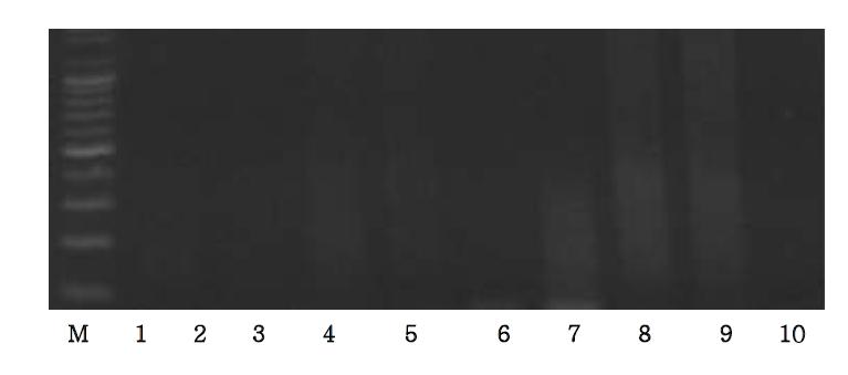 Agarose gel electrophoresis of PCR products using the Bos D-loop primer.